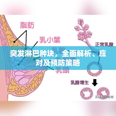 突发淋巴肿块，全面解析、应对及预防策略