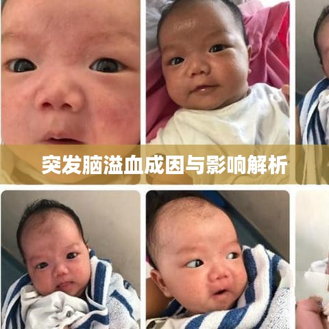突发脑溢血成因与影响解析